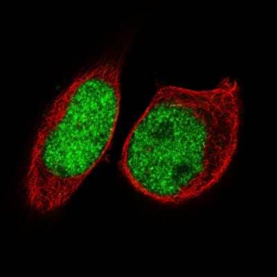 Immunocytochemistry/ Immunofluorescence: FoxP2 Antibody (CL5310) [NBP2-61412]