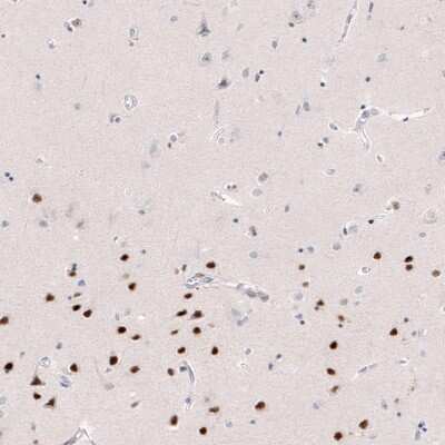 Immunohistochemistry-Paraffin: FoxP2 Antibody (CL5310) [NBP2-61412]