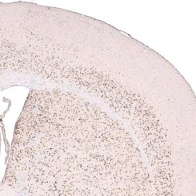 Immunohistochemistry-Paraffin: FoxP2 Antibody (CL5310) [NBP2-61412]