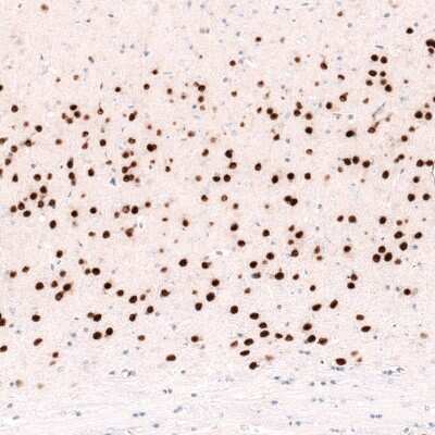 Immunohistochemistry-Paraffin: FoxP2 Antibody (CL5310) [NBP2-61412]