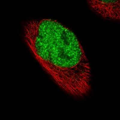 Immunocytochemistry/ Immunofluorescence: FoxP2 Antibody (CL5312) [NBP2-61413]