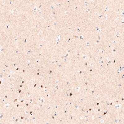 Immunohistochemistry-Paraffin: FoxP2 Antibody (CL5312) [NBP2-61413]