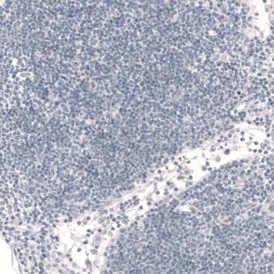 Immunohistochemistry-Paraffin: FoxP2 Antibody (CL5312) [NBP2-61413]