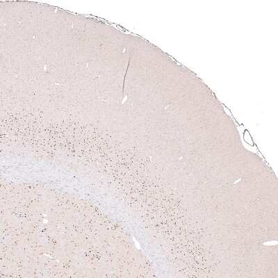 Immunohistochemistry-Paraffin: FoxP2 Antibody (CL5312) [NBP2-61413]