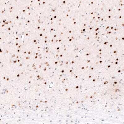 Immunohistochemistry-Paraffin: FoxP2 Antibody (CL5312) [NBP2-61413]