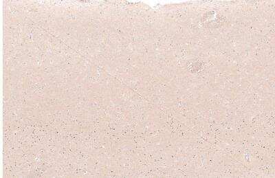 Immunohistochemistry-Paraffin: FoxP2 Antibody (CL5312) [NBP2-61413]