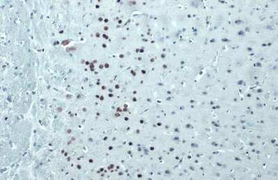 Immunohistochemistry-Paraffin: FoxP2 Antibody (GT12812) [NBP3-13696]