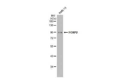 Western Blot: FoxP2 Antibody (GT12812) [NBP3-13696]