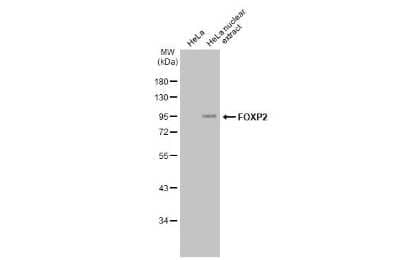 Western Blot: FoxP2 Antibody (GT12812) [NBP3-13696]