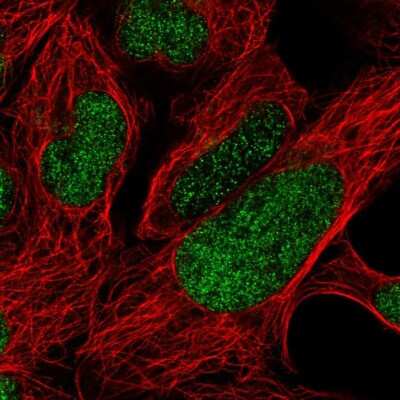 Immunocytochemistry/ Immunofluorescence: FoxP2 Antibody [NBP2-55618]