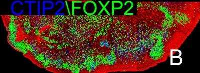 Immunohistochemistry: FoxP2 Antibody [NBP1-86671]