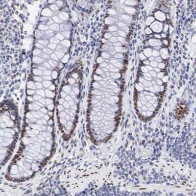 Immunohistochemistry-Paraffin: FoxP2 Antibody [NBP1-86671]