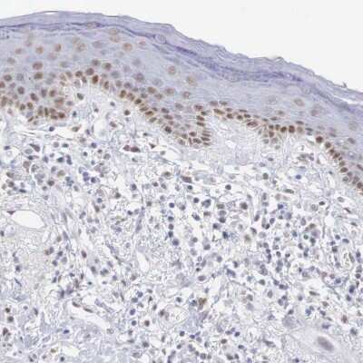 Immunohistochemistry-Paraffin: FoxP2 Antibody [NBP1-86671]