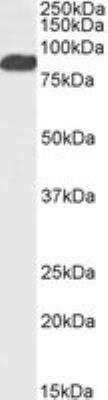 Western Blot: FoxP2 Antibody [NBP1-51907]