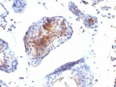 Immunohistochemistry-Paraffin: FoxP3 Antibody (FXP3/197) - Azide and BSA Free [NBP2-34620]