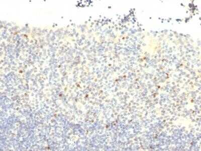 Immunohistochemistry-Paraffin: FoxP3 Antibody (FXP3/197) - Azide and BSA Free [NBP2-34620]