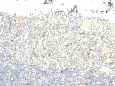 Immunohistochemistry-Paraffin: FoxP3 Antibody (FXP3/197) [NBP2-34282]