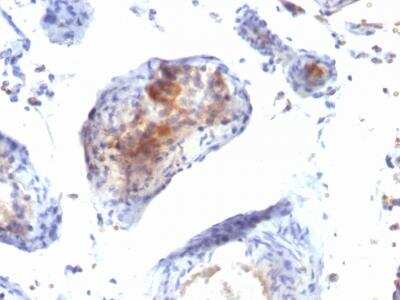 Immunohistochemistry-Paraffin: FoxP3 Antibody (FXP3/197) [NBP2-34282]