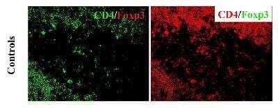 Immunohistochemistry-Frozen: FoxP3 Antibody - BSA Free [NB600-245]