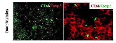 Immunohistochemistry-Frozen: FoxP3 Antibody - BSA Free [NB600-245]