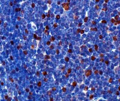 Immunohistochemistry: FoxP3 Antibody - BSA Free [NB100-39002]
