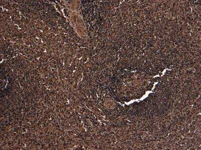 Immunohistochemistry: FoxP3 Antibody [NB600-242]