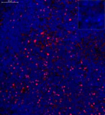 Immunohistochemistry-Paraffin: FoxP3 Antibody - BSA Free [NB100-39002]