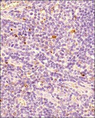 Immunohistochemistry-Paraffin: FoxP3 Antibody - BSA Free [NB100-39002]