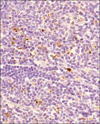 Immunohistochemistry-Paraffin: FoxP3 Antibody - BSA Free [NB100-39002]