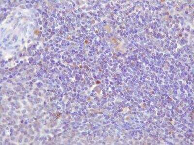 Immunohistochemistry-Paraffin: FoxP3 Antibody - BSA Free [NB100-39002]