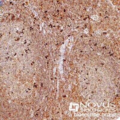 Immunohistochemistry-Paraffin: FoxP3 Antibody - BSA Free [NB600-245]