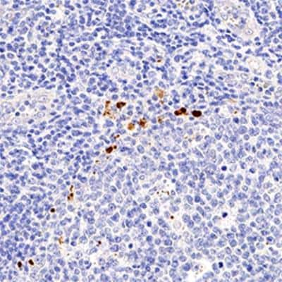 Immunohistochemistry-Paraffin: FoxP3 Antibody [NBP2-24397]