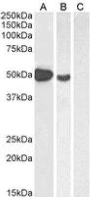 Western Blot: FoxP3 Antibody [NB600-242]