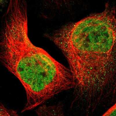 Immunocytochemistry/ Immunofluorescence: FoxP4 Antibody [NBP1-83449]