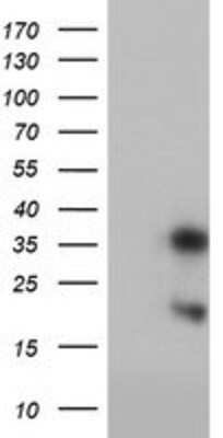 Western Blot: Frataxin Antibody (OTI1C12) [NBP2-01743]