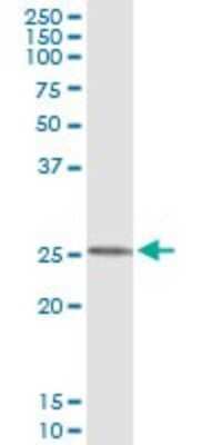 Immunoprecipitation: Frataxin Antibody (1D9) [H00002395-M01]