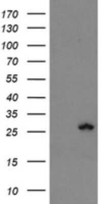 Western Blot: Frataxin Antibody (OTI3C7) [NBP2-45751]