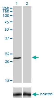 Western Blot: Frataxin Antibody (3G9) [H00002395-M03]