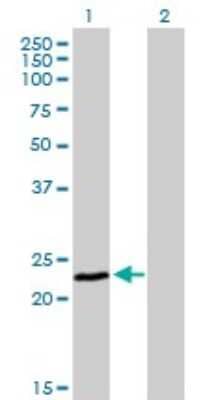 Western Blot: Frataxin Antibody (3G9) [H00002395-M03]