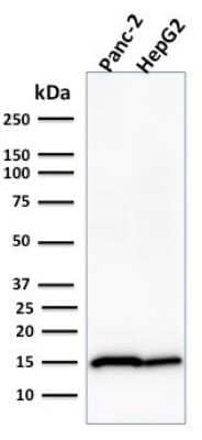 Western Blot: Frataxin Antibody (FXN/2124) [NBP2-79802]