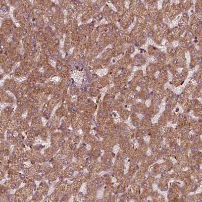 Immunohistochemistry-Paraffin: Frataxin Antibody [NBP2-57717]