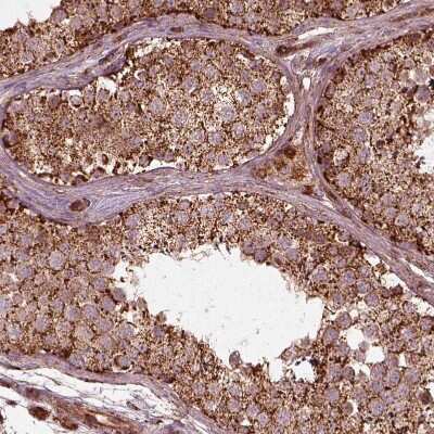 Immunohistochemistry-Paraffin: Frataxin Antibody [NBP2-57717]