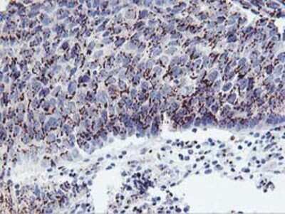 Immunohistochemistry: Frataxin Antibody (OTI1C12) - Azide and BSA Free [NBP2-70766]