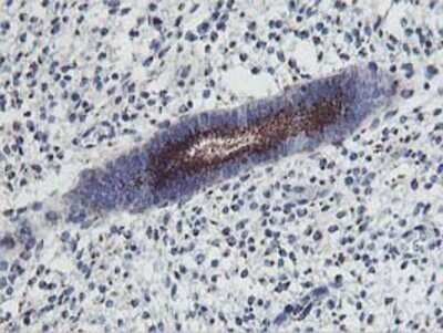 Immunohistochemistry: Frataxin Antibody (OTI1C12) - Azide and BSA Free [NBP2-70766]