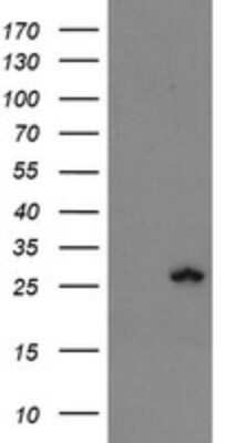 Western Blot: Frataxin Antibody (OTI3C7)Azide and BSA Free [NBP2-70769]