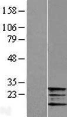 Western Blot: Frataxin Overexpression Lysate [NBL1-10871]