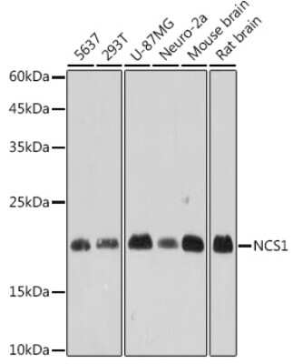 Western Blot: Frequenin Antibody (9W8J4) [NBP3-15269]