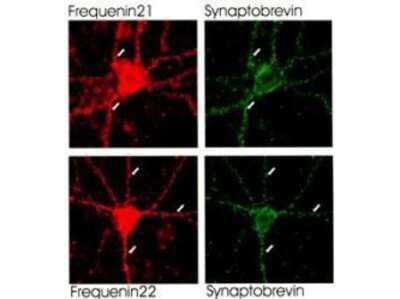 Immunocytochemistry/ Immunofluorescence: Frequenin Antibody [NBP1-78006]