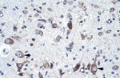 Immunohistochemistry: Frequenin Antibody [NBP3-10322]