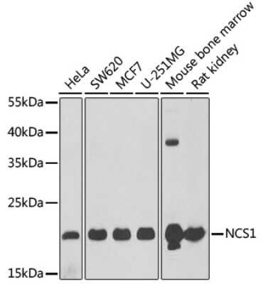 Immunohistochemistry-Paraffin: Frequenin Antibody - BSA Free [NBP3-03315]